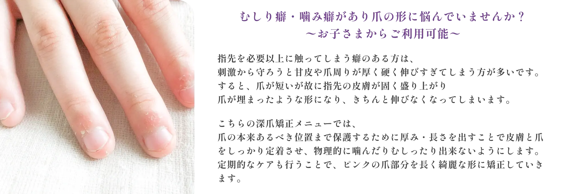 むしり癖・噛み癖があり爪の形に悩んでいませんか？～お子様からご利用可能～